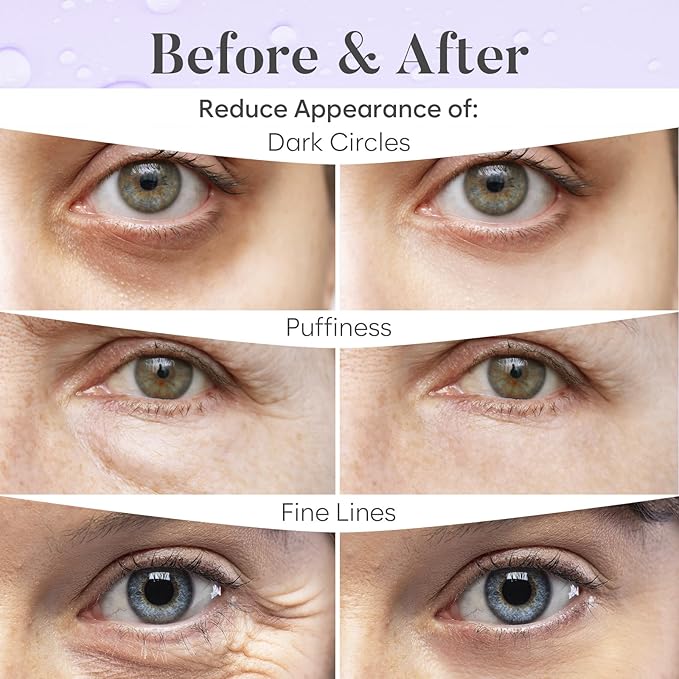 BLOOMORA Under Eye Patches for Puffy Eyes and Dark Circles, Gel Eye Masks with Caffeine, Collagen & Vitamin C, Deeply Moisturizing, Bachelorette Party Favors, Bridesmaid Gifts (30 Pairs, Day & Night)