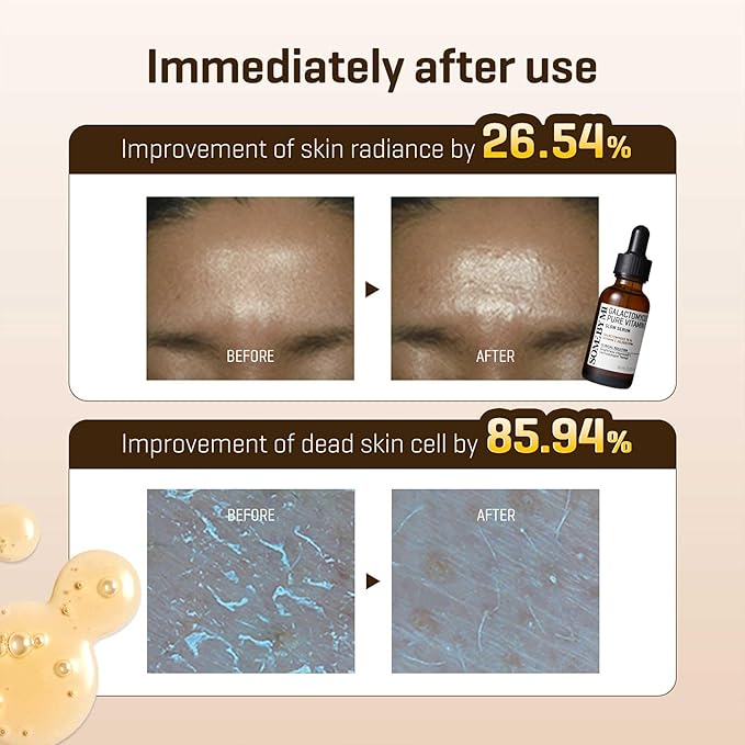 SOME BY MI Galactomyces Pure Vitamin C Glow Serum - 1.01Oz, 30ml - Korean Vitamin C Face Serum for Glow Glass Skin - Dark Spot Correcting Ampule with Brightening and Elasticity Care - Korean Skin Care