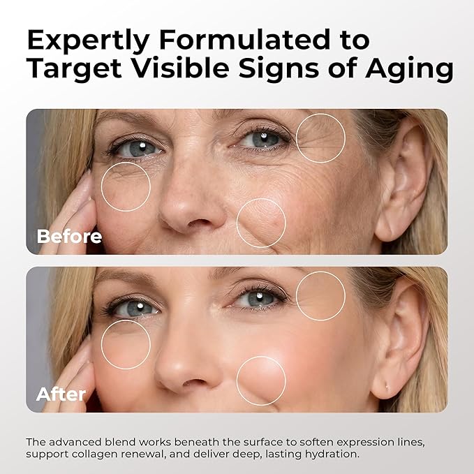 SKIN DEVA 20% Argireline Serum with Matrixyl 3000 Pure Hyaluronic Acid Serum For Face Deep Wrinkle Reducer Anti Aging Tones Skin and Stimulates Collagen Peptides Serum For Face - Pack of 2