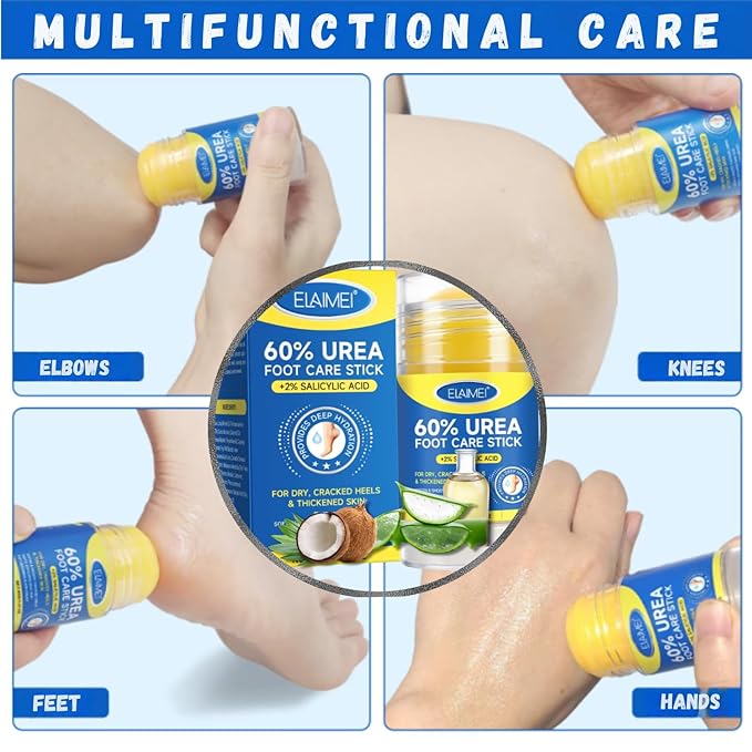 60% Urea Cream Stick with 2% Salicylic Acid, Maximum Strength Urea Foot Cream for Dry Cracked Heels & Feet, Callus Remover, Heel Balm, Fast Absorbing Moisturizer for Rough Hands, Knees & Elbows 1.41oz