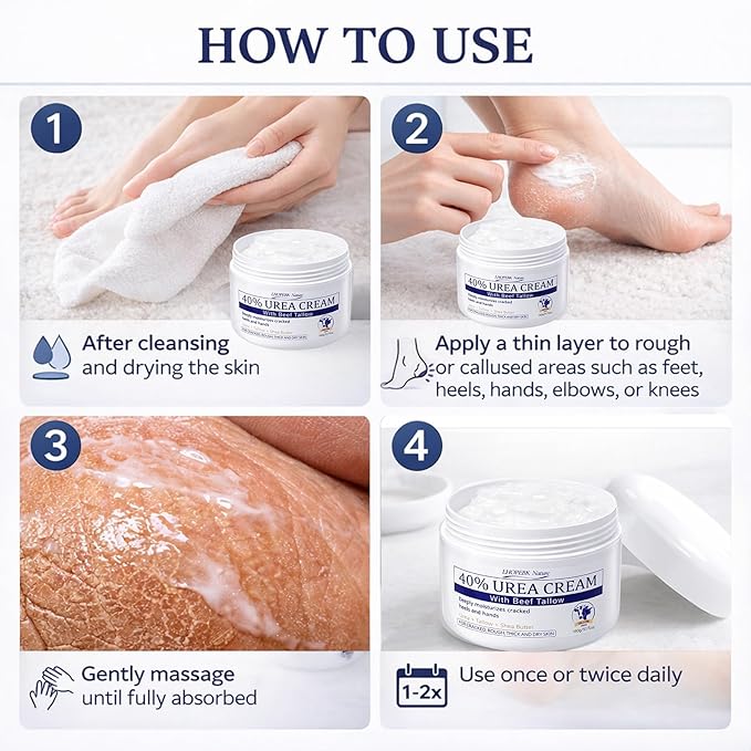 Urea Cream for Feet Cracked Moisturizing: 24H Moisture Maximum Strength Formula for Cracked Heels & Hands - Enriched with 40% Urea Beef Tallow & Salicylic Acid Fast Absorbing - 5 OZ