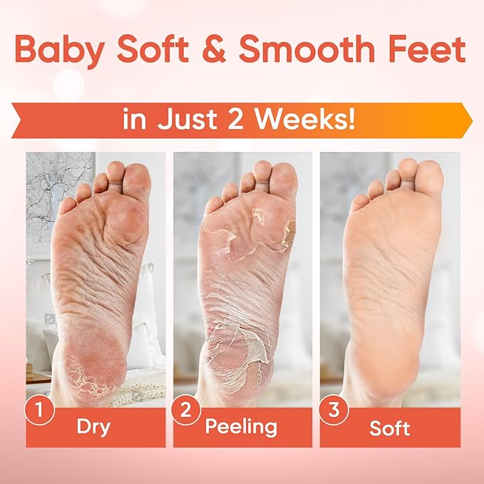 CÉLOR Foot Peeling Mask for Dry Cracked Feet | Foot Mask to Exfoliate Rough, Cracked, Dry Feet, Calluses for Soft Baby Feet Results | Made with Aloe Vera Extract for Women & Men (2 Pairs) | Peach