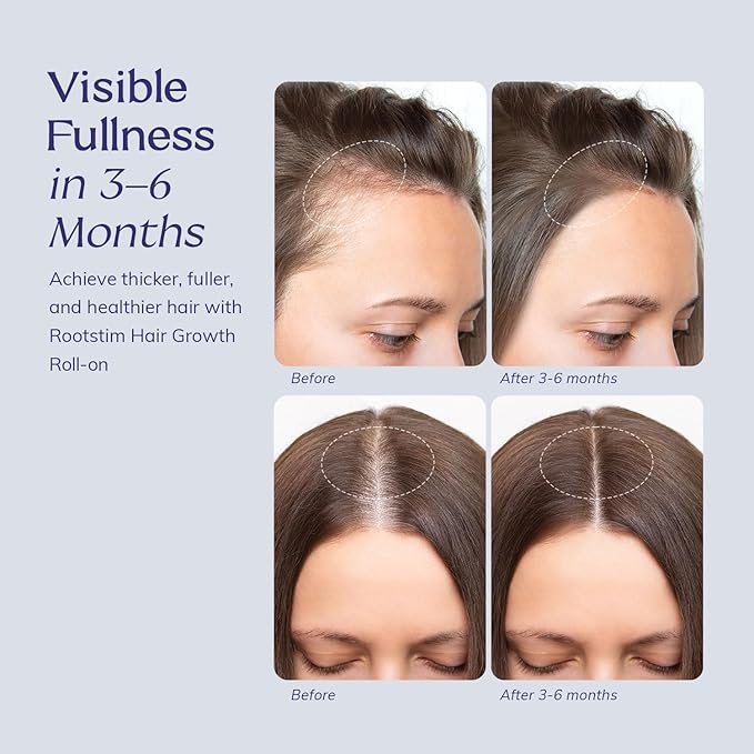 Hair Growth Serum Roll On with Rosemary, Caffeine & Biotin, Helps Support Fuller-Looking Hair, Clean Non-Greasy Scalp Serum for Thinning Hair 2-pack, 2.16 Fl Oz