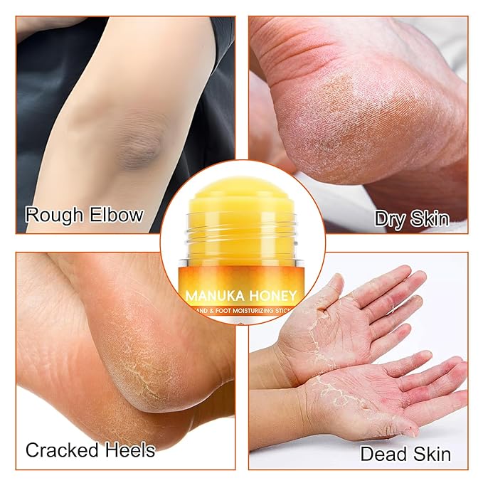 2 Pack Manuka Honey Cracked Heel Treatment Balm Stick, Dry & Cracked Foot Repair for Intensively & Deeply Moisturizing & Hydrating, Soothing, with Shea Butter, Chamomile|1.41 Oz/40 G