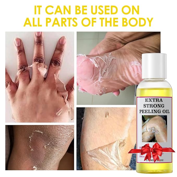 Yellow Peeling Oil Extra Strength Exfoliating Solution for Body - Dark Skin KP Bump Eraser Body Scrub Ingrown Hair Keratosis Pilaris Treatment