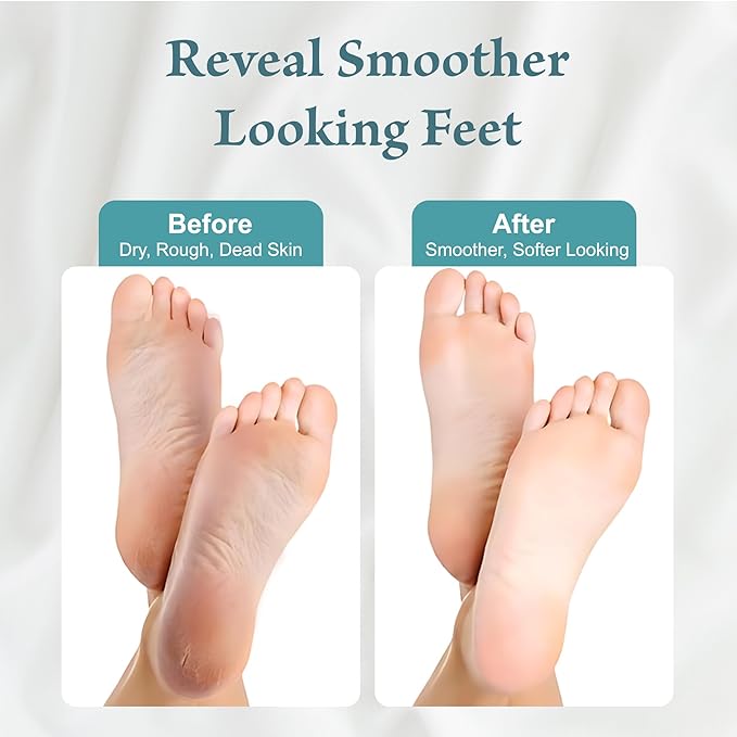 Foot Peel Mask 2 Pack, Exfoliating Foot Mask for Dead Skin & Callus Removal, Peeling Treatment with Lactic Acid, Aloe Vera & Lavender, Smooth Soft Feet at Home for Men & Women