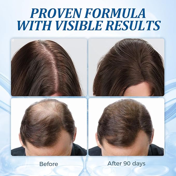 GHK-Cu Peptide Hair Serum, Copper Peptides for Hair Growth, Lightweight Scalp Serum for Thinning Hair, Non-Greasy GHK-Cu Peptide Hair Support for Men and Women
