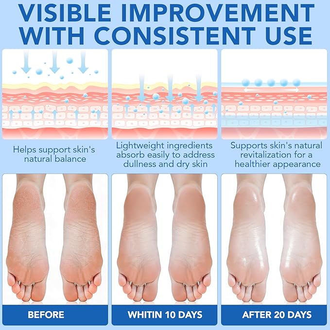 Urea Cream 60% with Salicylic Acid 2% Urea Foot Care Stick, Foot Cream for Dry Cracked Feet, Heels, Knees, Hands, Elbows, Feet Moisturizer Stick for Callus Remover & Skin Softener (40g (Pack of 1))