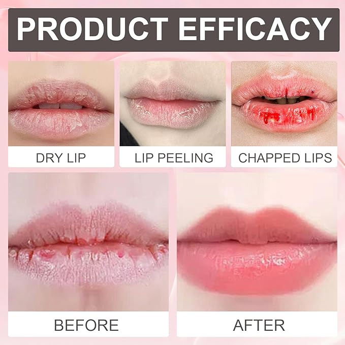 Lip Booster Plumping Serum - 24-Hour Volumizing Lip Treatment, Deeply Hydrating & Nourishing Gloss for Dry Lips, Enhances Lip Elasticity - Glovera Labios Carnosos (1PC)