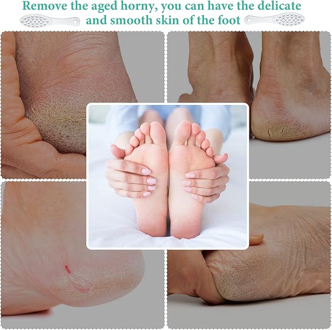 2 Pcs Stainless Steel Foot File Callus Remover Double Sided Metal Foot Rasp Scrubber for Wet or Dry Skin Professional Pedicure Tool for Hard Skin & Cracked Heels, Easy to Clean (Classic Style)