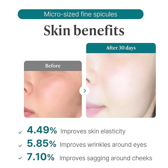 VELY VELY Nano Spicule 1200ppm Lifting Cream - Anti‑Aging Wrinkle Microneedling Face Moisturizer for Women, 10 Peptides, 50ml / 1.69 oz