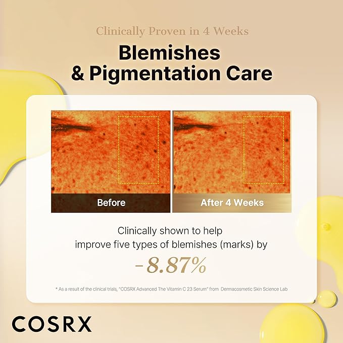 COSRX Advanced Pure Vitamin C 23% Serum with Vitamin E & Glutathione, Korean Vitamin C Serum for Fine Lines, Uneven Skin Tone & Dull Skin, 0.7oz, Korean Skin Care