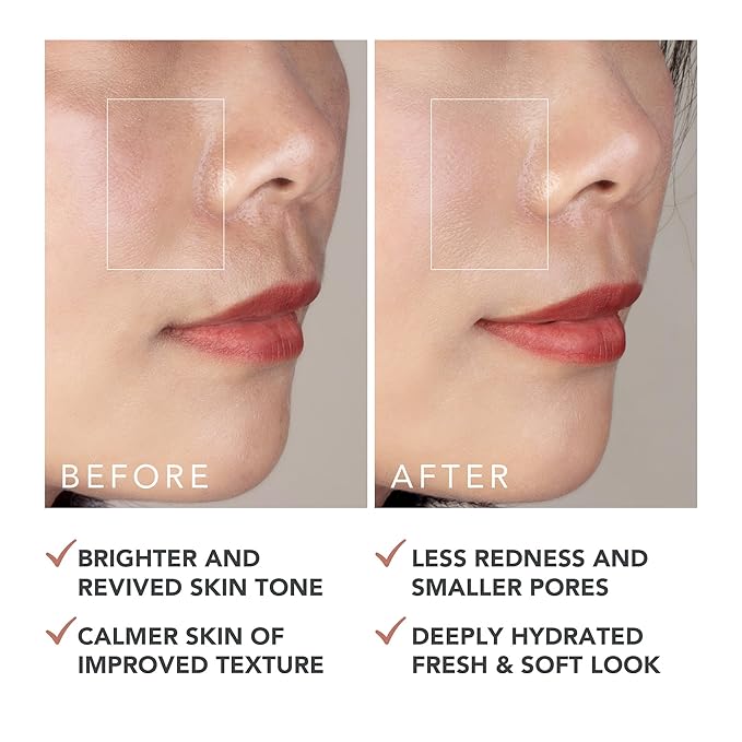 FOREO SUPERCHARGED Barrier Restoring Essence Mist, 3.7 fl oz - Collagen Boosting Spray Moisturiser - Collagen Peptides, Niacinamide, Centella Asiatica, Panthenol - Face Mist For All Skin Types
