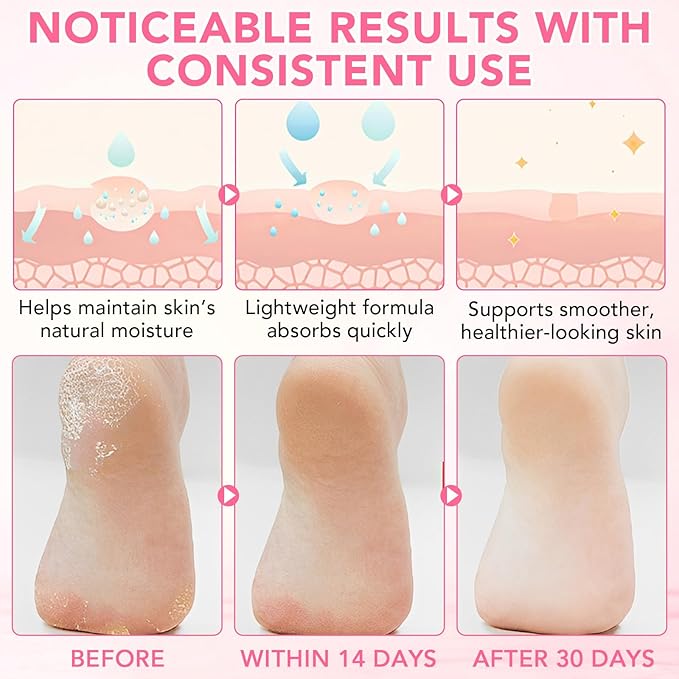 60% Urea plus 2% Salicylic Acid Foot Care Stick, Deep Hydration Soften & Smooth Thickened Areas, Intensive Moisturizer Repairs for Dry, Cracked Heels & Thickened Skin (1.41 Ounce, Peach)