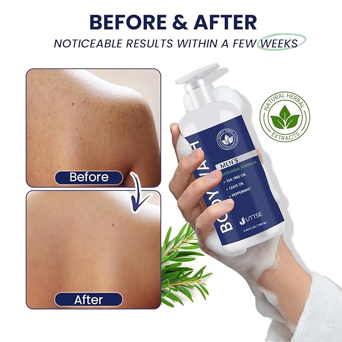 Uttse Tea Tree Body Wash: Antifungal Soap for Men - Eliminates Body Odors & Skin Irritations - 11.8fl oz/350mL