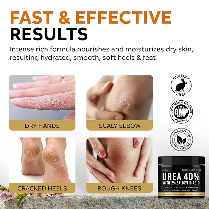 Adellina Urea Cream 40 Percent for Feet Maximum Strength, Urea Foot Cream for Dry Cracked Heels Feet Knees Elbows, 40% Urea Foot Repair Lotion 5.3 OZ