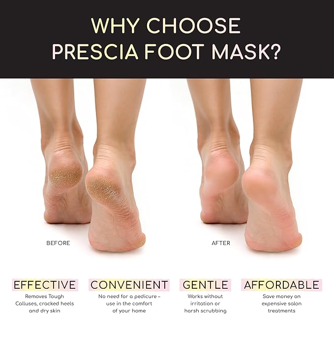 Prescia Foot Peel Mask - For Cracked Heels, Dead Skin & Calluses - Baby Soft Feet, Smooth Skin, Removes & Repairs Rough Heels, Dry Toe Skin - Exfoliating Peeling Natural Treatment - Crescena