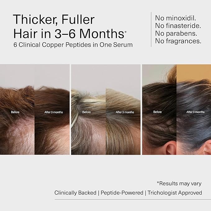 Bloom Clinically Proven Copper GHK-CU Peptide Hair Serum for Hair Growth - Multi Copper Peptides Non-Greasy & Lightweight for Thinning Hair - Promotes Fullness, Reduces Shedding - Made in USA