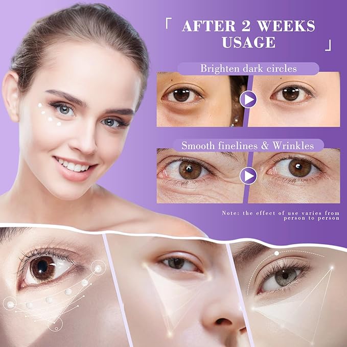 Eye Cream, Retinol Eye Cream for Dark Circles, Puffiness Anti Aging, with Hyaluronic Acid, Peptides and Caffeine, Reduces Bags, Smooths Fine Lines and Wrinkles, Hydrating Firming Eye Treatment