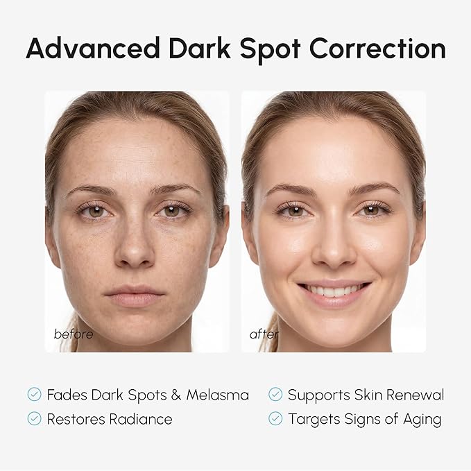 MAREE 10% Tranexamic Serum Cream - Alpha Arbutin Cream with Tranexamic Acid, Niacinamide - Dark Spot Corrector with Alfa Arbutin - Acido Tranexamico Crema para Manchas Oscuras en la Cara
