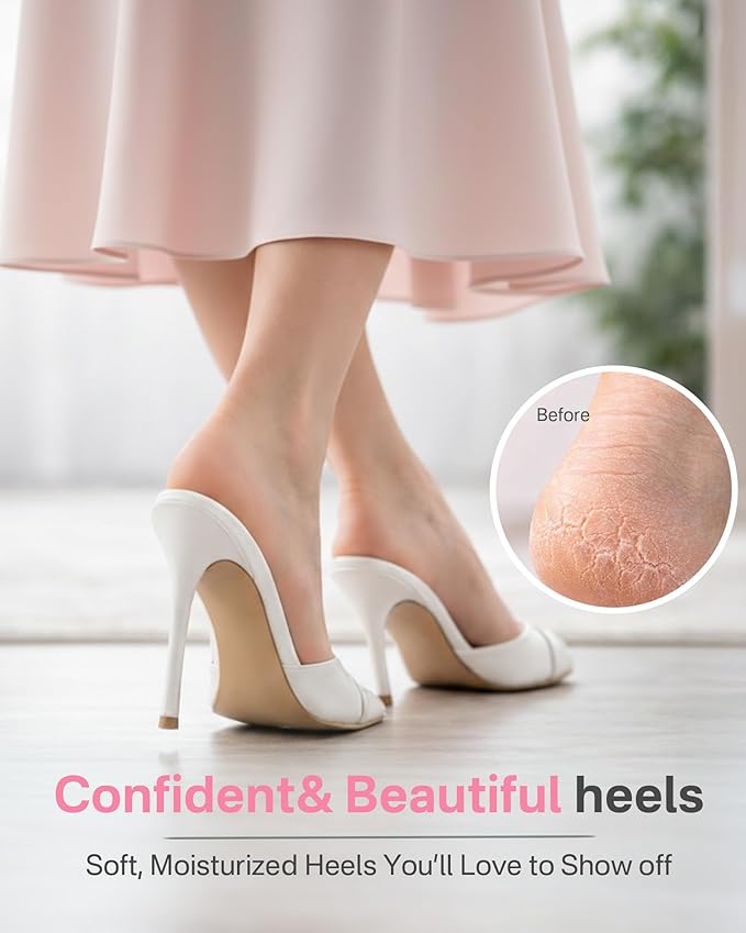 Moisturizing Socks, 100% Cotton Heel Socks for Dry Cracked Feet Women, Cracked Heel Treatment Silicone Heel Socks, Breathable Hydrating Gel Heel Protectors for Repair, Spa & Daily Use, 2 Pairs, Pink