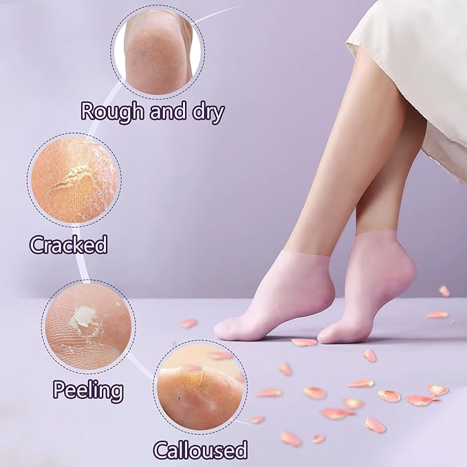 TEAWOO 2 Pairs Silicone Socks for Dry Cracked Feet, Women's Foot Socks for Moisturizing (2 Colors Assorted, Fits Up to Size 11)