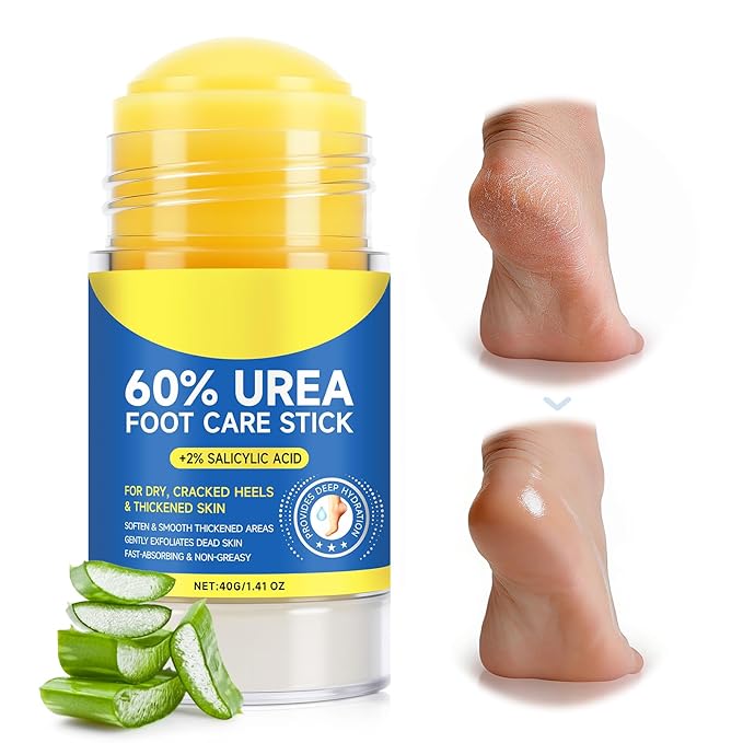 60% Urea Cream Stick with 2% Salicylic Acid, Maximum Strength Foot Cream Stick for Dry Cracked Heels & Calluses, Rapidly Softens Thick Skin - Non-Greasy & Fast Acting - 2-Day Visible Results