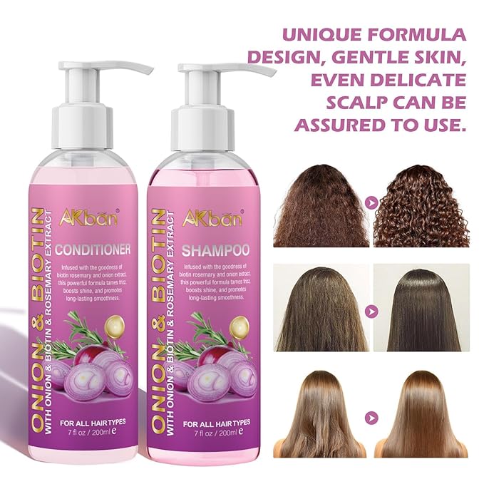 Onion Rosemary and Biotin Shampoo and Conditioner Set for Strengthening, Moisturizing & Encouraging Longer, Healthier Hair, Hair Loss and Thinning Hair, Paraben-Free, Growth Shampoo and Treatment Set