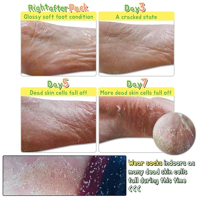 Elizavecca/Foot Peel /1 Foot Pack 2 Pairs Foot Mask - Boots for Exfoliating/foot pack review/foot pack before and after