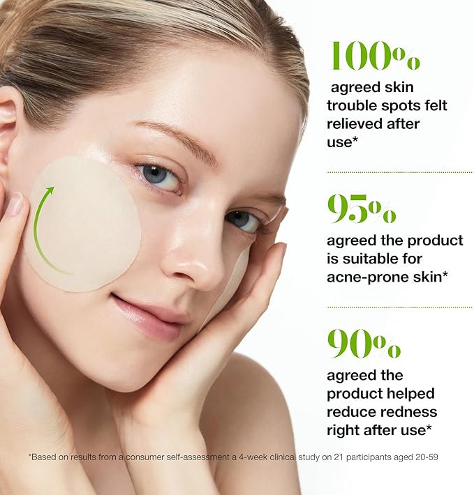 ANUA Azelaic Acid 10 Hyaluronic Acid Soothing Toner Pads, Hydrating Facial Mask for Redness, Pore & Blemish Care, Quick & Easy Stretchable Formula, Korean Skincare, 90 Pads