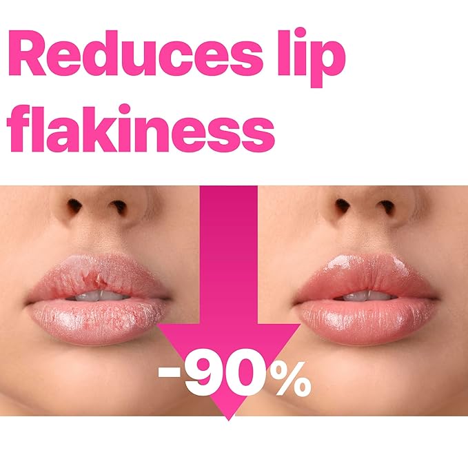 ISOI Refresh Lip Sleeping Mask, Overnight Hydrating Lip Treatment with 4X Ceramide & Botanical Oils, Korean Lip Care (0.88 oz, 25g)