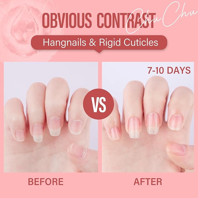 CHUCHU Vegan Cuticle Oil for Nail: Rose Scent Natural Vitamin B & E Nail Oil - Hydrates Moisturizes Repairs for Nails Damage Dry Cuticle 0.51 Fl Oz