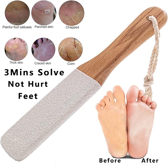 Kinepi Callus Remover Foot Scrubber Colossal Foot File Foot Care and Foot Exfoliator Foot Rasp Pedicure Tools Pumice Stone for Feet,Remove Corn Hard Skin Dead Skin for Use in Shower Foot Scraper Kit