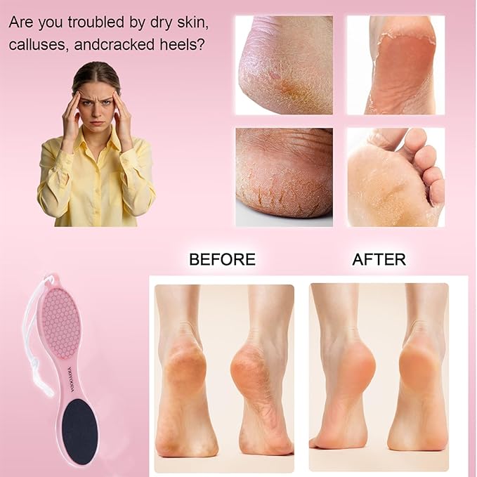 4-in-1 Nano Glass Foot Callus Remover, Professional Foot File (Glass, Rasp & Sand Paper), Durable Foot Scrubber Pedicure Tools for Hard and Dead Skin Remover, Soft Smooth Feet, 2 Pcs Pink