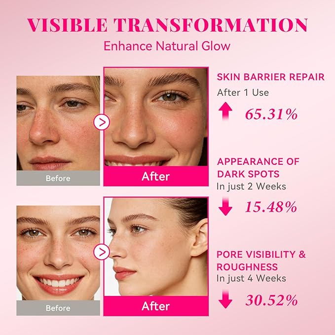 ANAiRUi PDRN Serum 1% for Face, 10000ppm Salmon DNA with 5% Tranexamic Acid & Niacinamide, Skin Repair Barrier Support Serum with Ceramides & Hyaluronic Acid, Lightweight Hydrating Skincare 1.05 fl oz