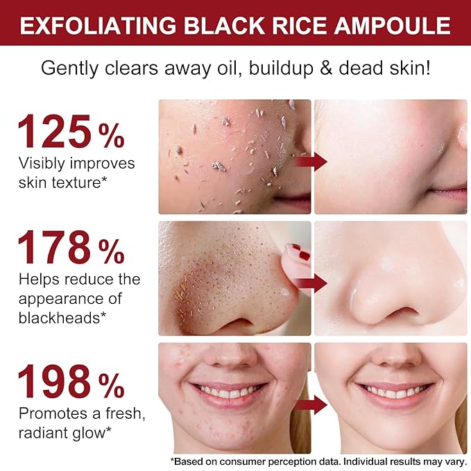 Black Rice Exfoliant and White Rice Ampoule Exfoliant, Peel Shot Glow Exfoliating Face Serum, Korean Skin Care Soft Exfoliating Body Scrub Dead Skin Cells, Blackheads Remover For All Skin Types 100ml