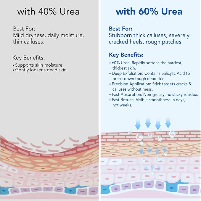 60% Urea Cream Stick with 2% Salicylic Acid, Maximum Strength Urea Foot Cream for Dry Cracked Heels, Callus Remover, Rapidly Softens the Hardest, Thickest Skin. Visible Smoothness in Days, Non-Greasy