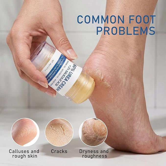 2Pcs Urea Cream 60% plus 2% Salicylic Acid Urea Foot Cream Stick,Foot Cream for Dry Cracked Heels and Feet,Hands,Elbows,Knees,Exfoliating Moisturizer,Soften Dead Skin Foot Balm,1.41 Oz