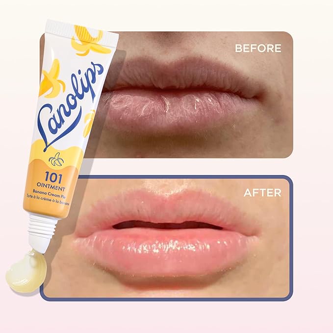 Lanolin 101 Multipurpose Ointment - Lanolin Lip Balm & Healing Ointment for Skin Barrier Repair - Moisturizer for Dry Lips, Cuticles & Elbows - No Petroleum Formula - Banana Cream Pie (0.35 oz)