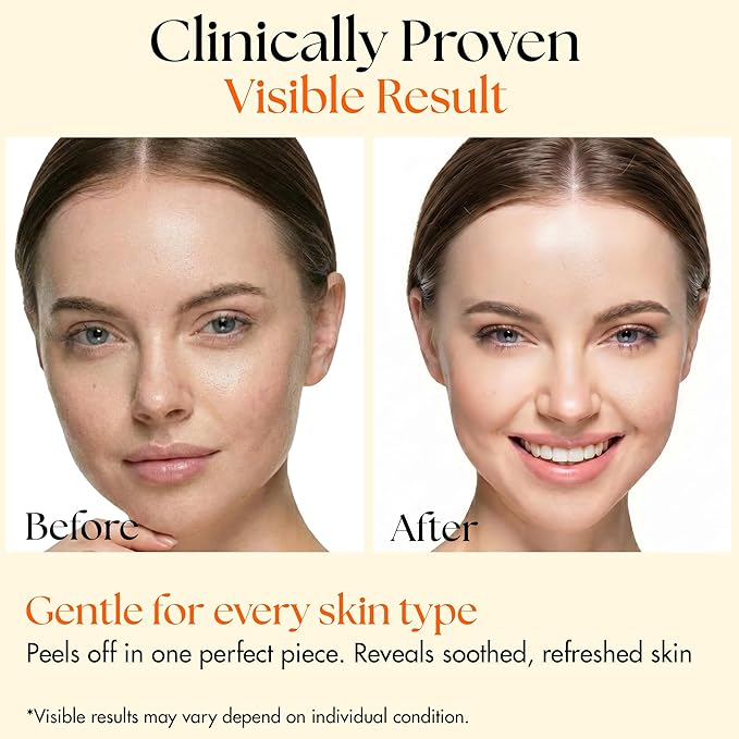 Clinical Resolution PDRN Collagen Night Wrapping Mask, All-In-One Nourish, Revitalize, Radiance for Youthful Glowing Skin Overnight Peel Off Face Mask Korean Skin Care Lab, 100ml 5 Pack