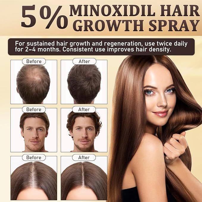 5% Minoxidil for Men & Women - Hair Growth & Beard Regrowth Biotin Serum with Rosemary & Batana Extract, Extra Strength Hair Loss Treatment to Regrow Thicker & Fuller Hair, 3.38 Oz