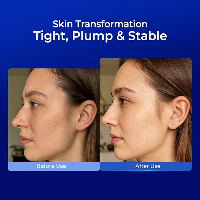 Full Spectrum Hyaluronic Acid Serum with Copper Peptides, For Microneedling & Post Treatment Care, Fast Redness Relief, Anti Aging Firming Hydrating Soothing Repair Serum for Sensitive Skin