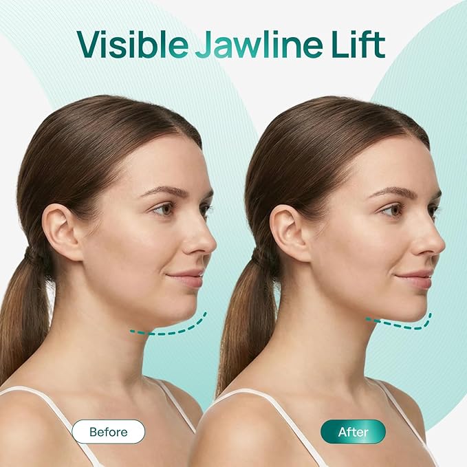 PLANTIFIQUE V-Line Chin Lifting Mask with Hyaluronic Acid & Aloe Vera, 20 Pcs - Double Chin Reducer, Jawline Shaper, Neck Firming and Tightening
