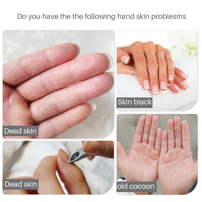 VolksRose Lavender Hand Mask Gloves - Overnight Hand Moisturizing Gloves for Dry Cracked Hands Repair, 5 Pairs Softening Spa Treatment for Rough Skin, Self Care Gifts Set for Women, Stocking Stuffers
