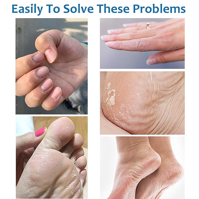 60% Urea Foot Cream Stick - Foot Care Balm Moisturizer for Dry Cracked Feet Hands Knees Elbows Hands Maximum Strength - 2Pcs Moisturizing Heel Balm Hydrates Calluses Remover Rough Skin Softener 1.41oz