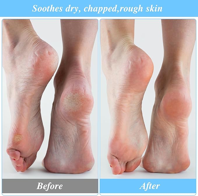3 Pairs Foot Moisturiser Socks Overnight, Spa Cotton Socks for Foot Cream, Lotion Sock for Moisturising for Dry Feet Care, Moisturising Sock for Cracked Heel Repair Women Men (Black)