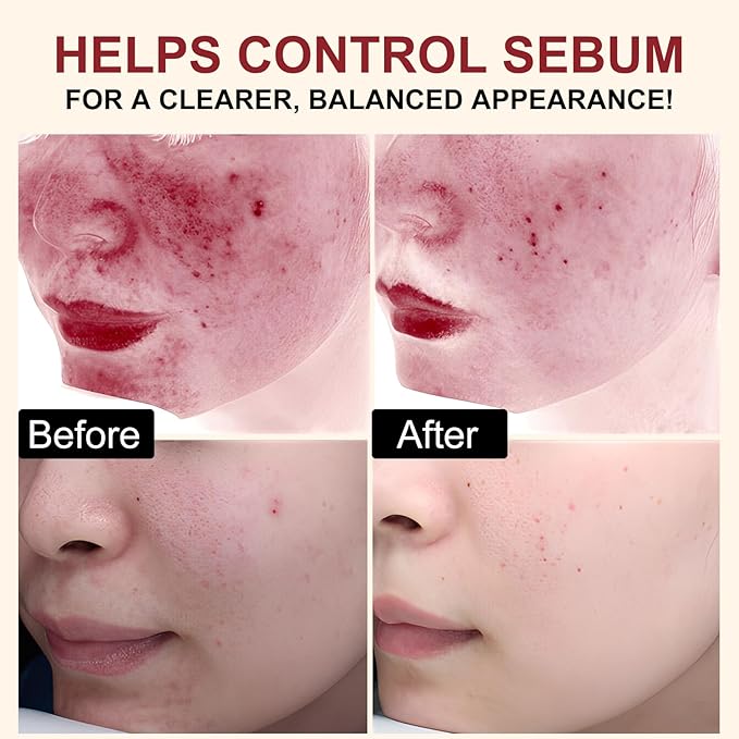 White Rice Exfoliant, White Rice Peeling Glow Ampoule, Peel Shot Glow Exfoliating Face Serum, Korean Skin Care Soft Exfoliating Body Scrub Dead Skin Cells, Blackheads Remover For All Skin Types 100ml