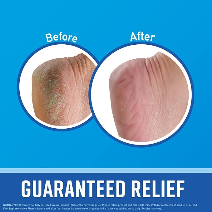 O'Keeffe's for Healthy Feet Foot Cream; Guaranteed Relief for Extremely Dry; Cracked Feet; Instantly Boosts Moisture Levels; 3.2 Ounce Jar; (Pack of 6)