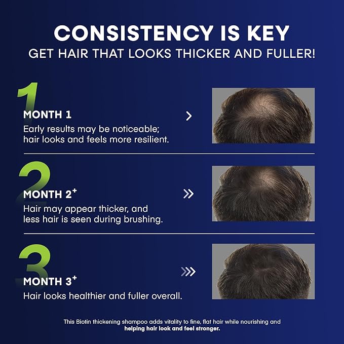 Svvimer Biotin Hair Growth Shampoo - Root Activator Thickening Shampoo for Men - With Rosemary Tea Tree Oil Caffeine For Hair Loss And Thinning Thickening - 13.5 Fl Oz