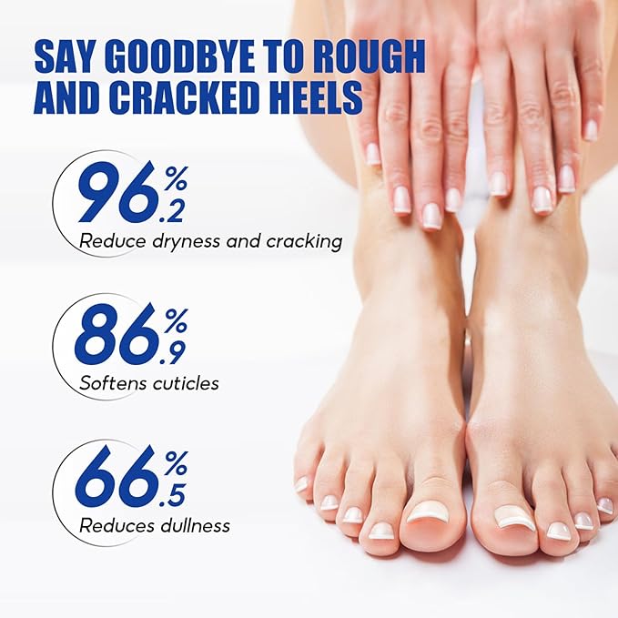 NovaCharm 2PCS Urea Cream 60 Percent for Feet, Maximum Strength Urea Foot Cream Stick, Foot Moisturizer Lotion for Cracked Heels, Dry Hands & Rough Knees (1.4Ounce(Pack of 2), Aloe Vera)